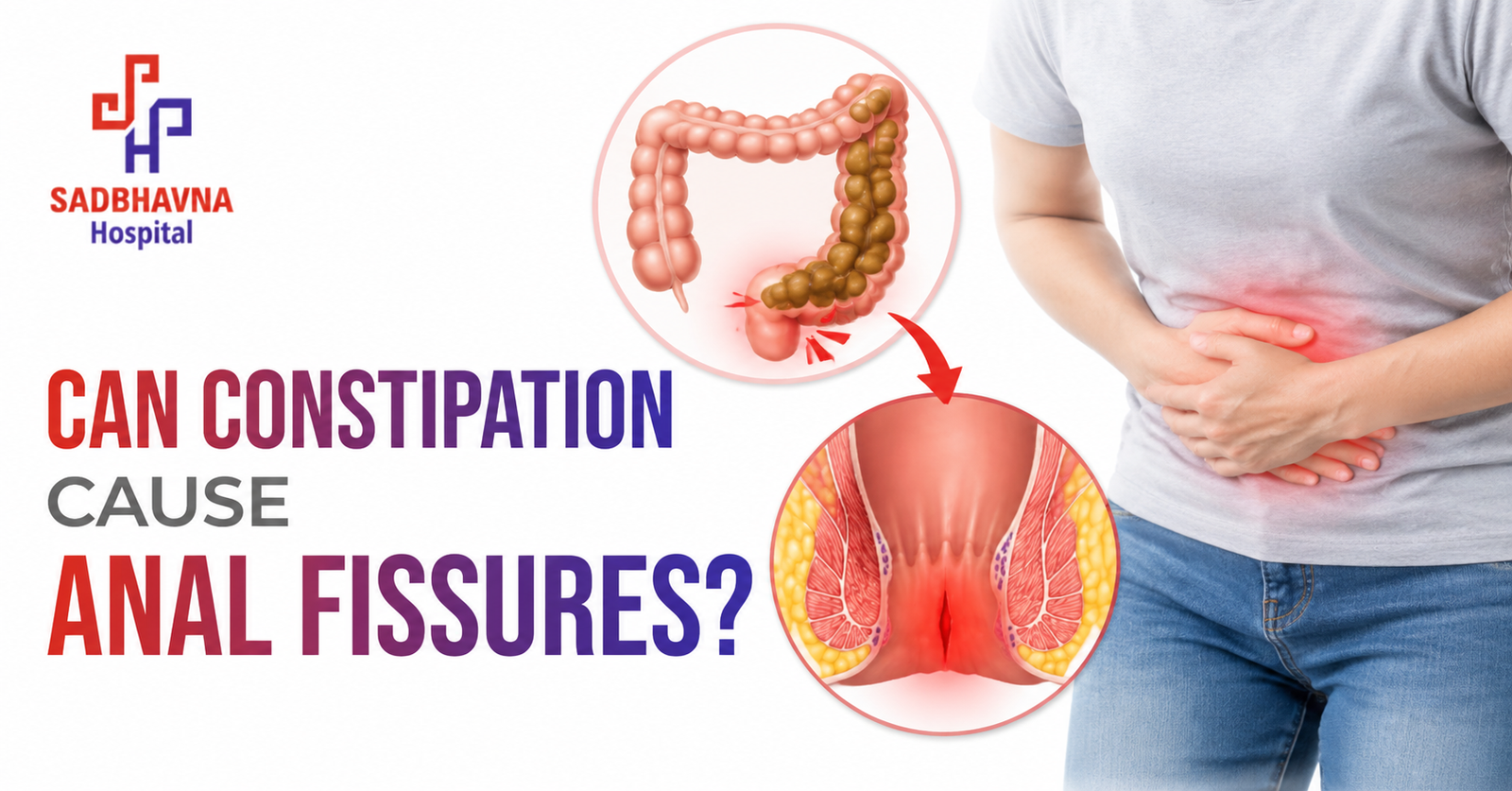 Can Constipation Cause Anal Fissures?