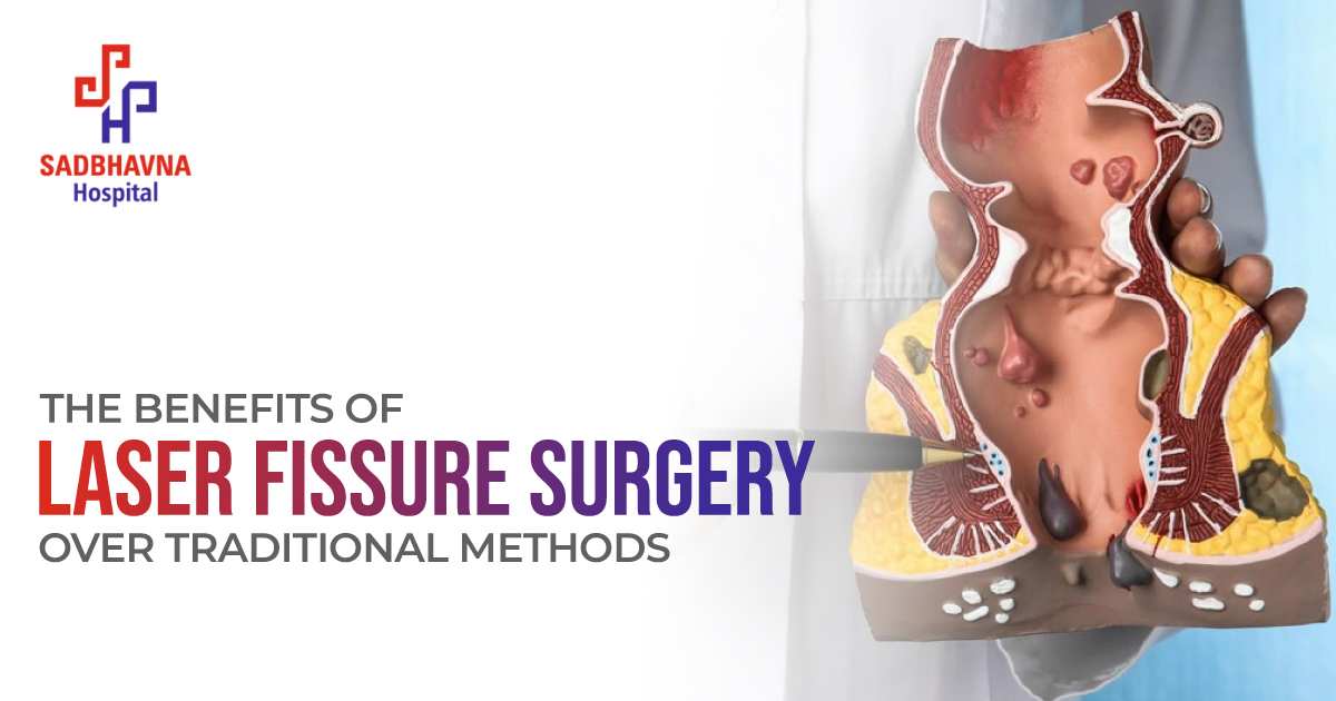 laser fissure surgery