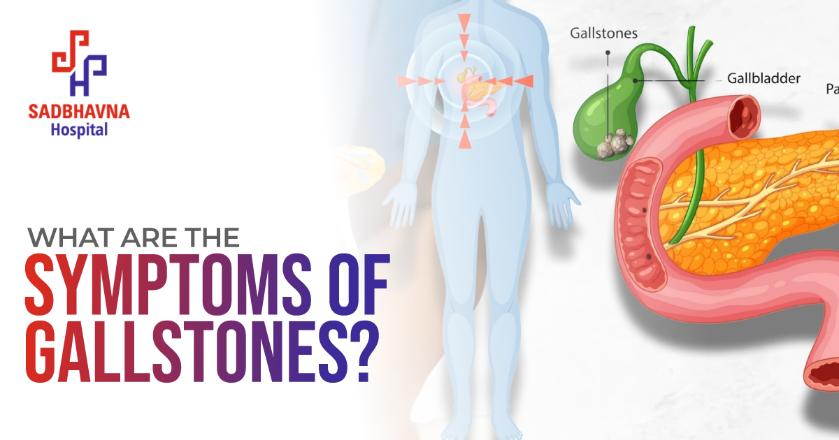What Are the Symptoms of Gallstones