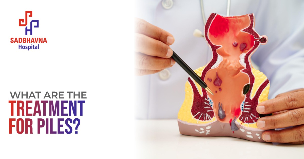 treatments for piles