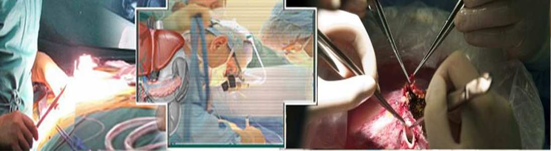 Gallbladder Stone Surgeon In Ahmedabad